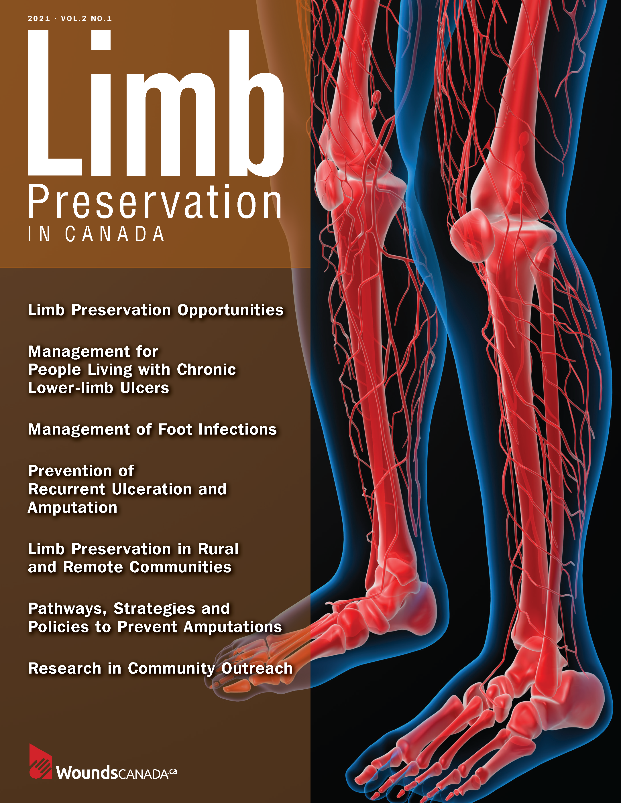 Limb Preservation in Canada