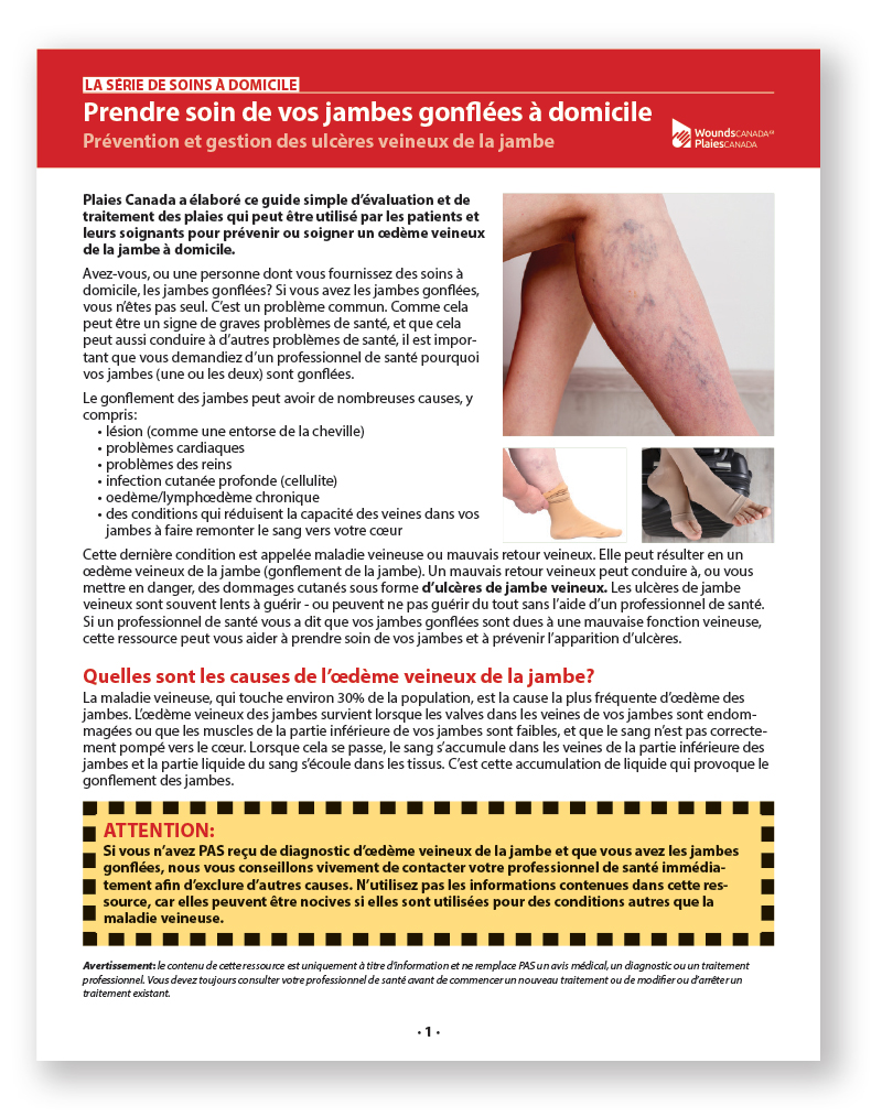 Prévention et gestion des ulcères veineux de la jambe