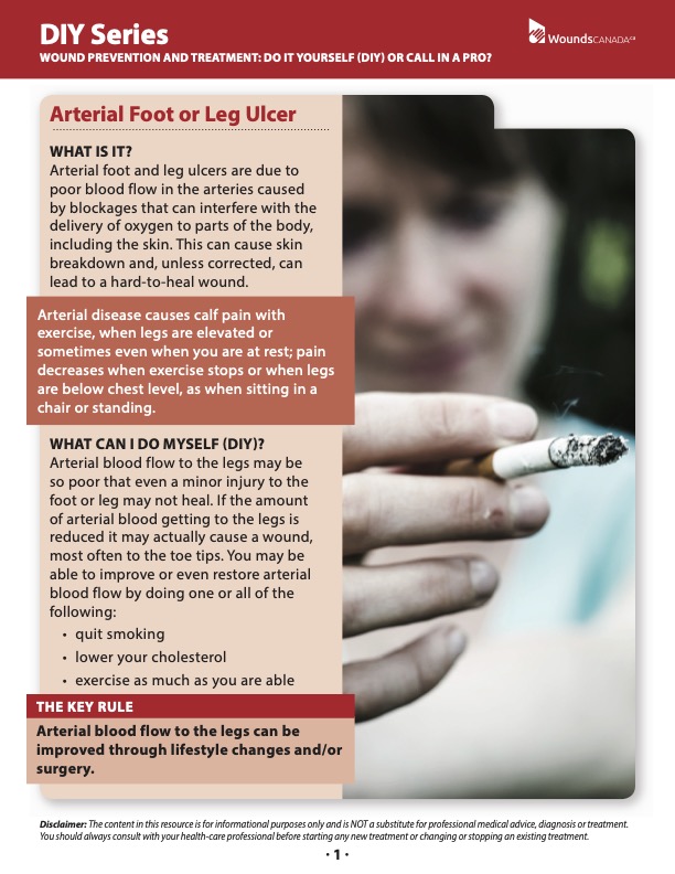 Arterial Foot and Leg Ulcers