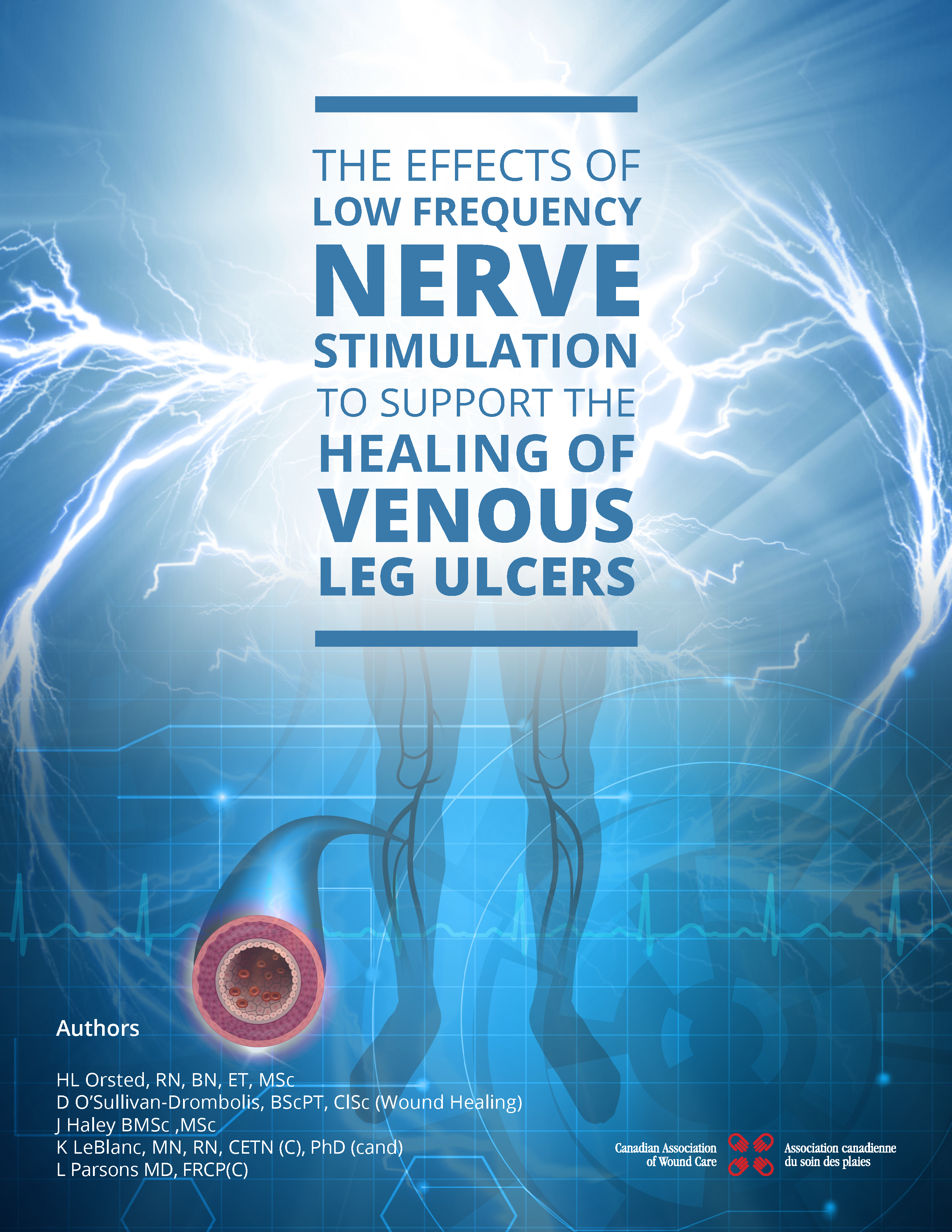 The Effects of Low Frequency Nerve Stimulation to Support the Healing of Venous Leg Ulcers
