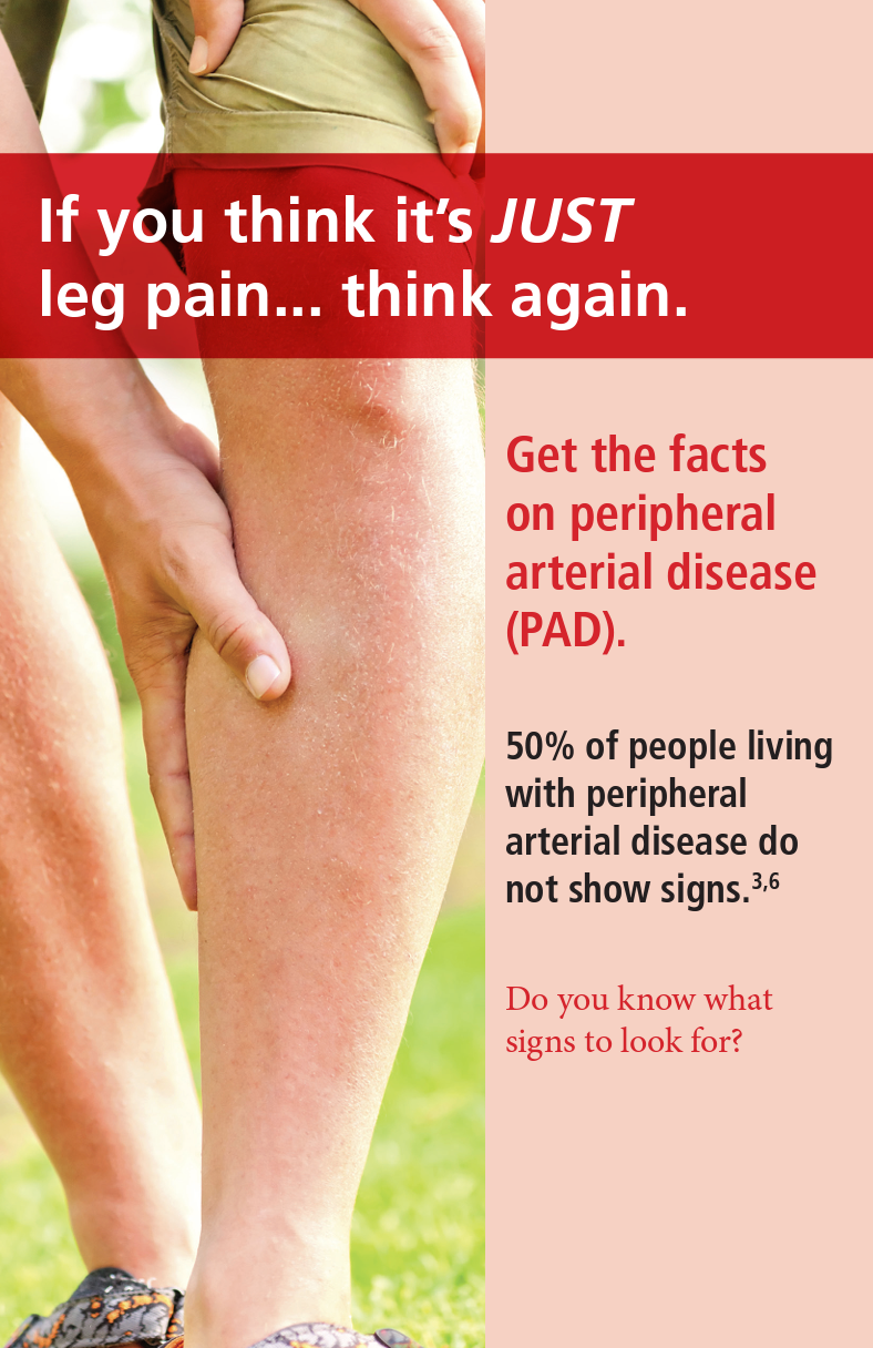 Facts on Peripheral Arterial Disease (PAD) for Patients