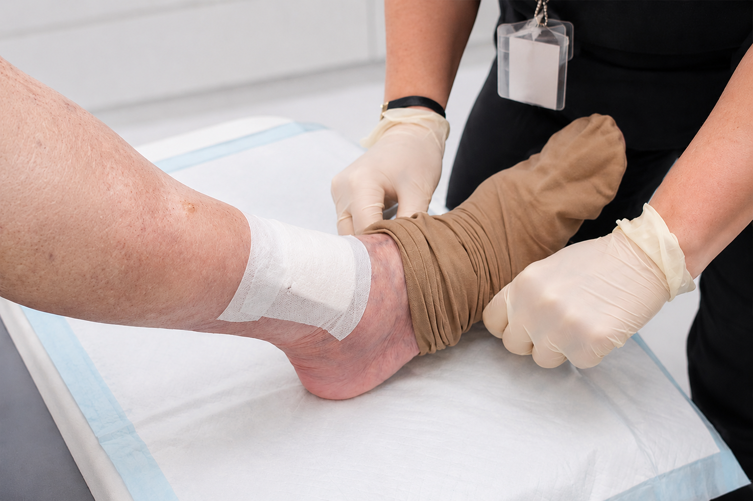 Venous Leg Ulcers