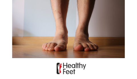 Diabetes Healthy Feet
